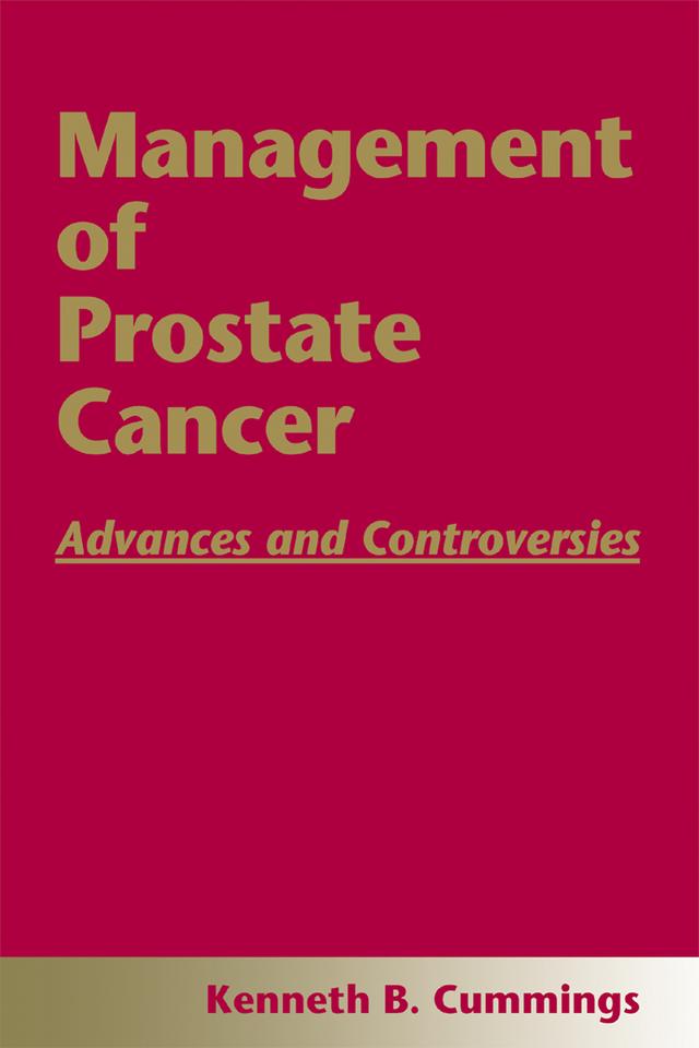Management of Prostate Cancer by Kenneth B. Cummings