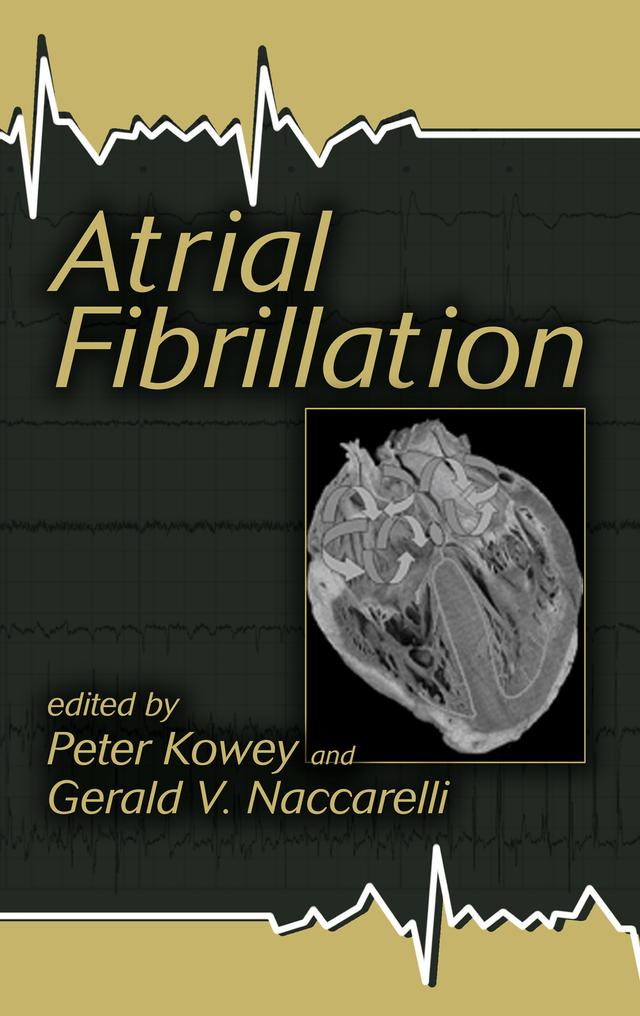 Atrial Fibrillation by Gerald Naccarelli, Peter Kowey
