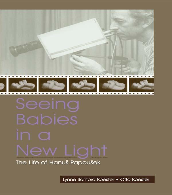 Seeing Babies in a New Light by Otto Koester