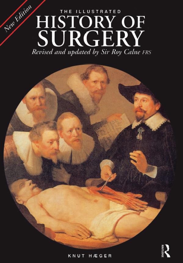 The Illustrated History of Surgery by Sir Roy Calne