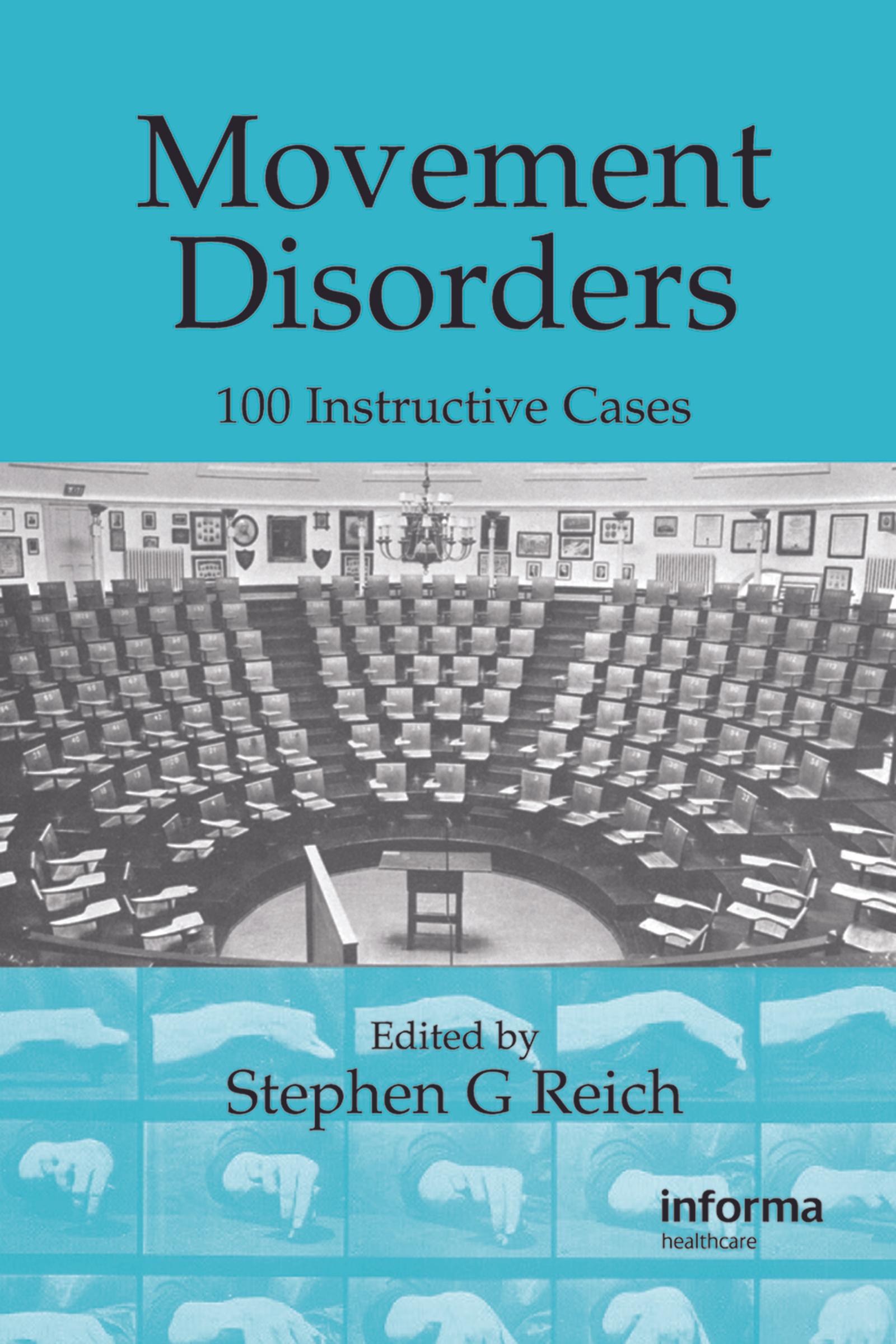 Movement Disorders