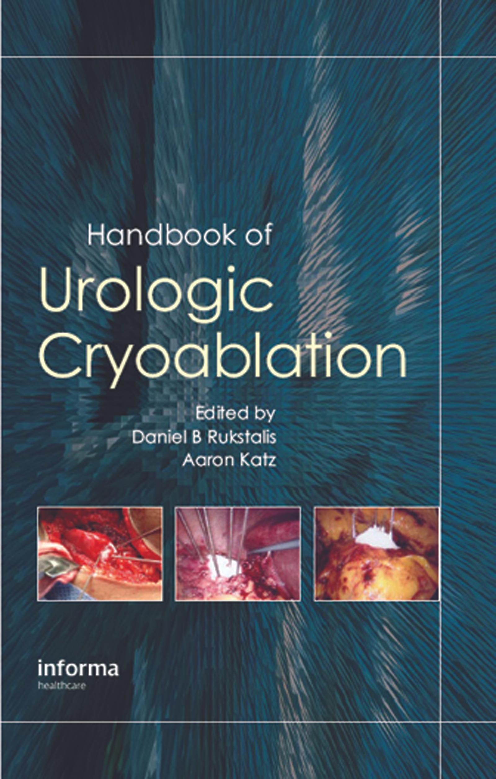Handbook of Urologic Cryoablation
