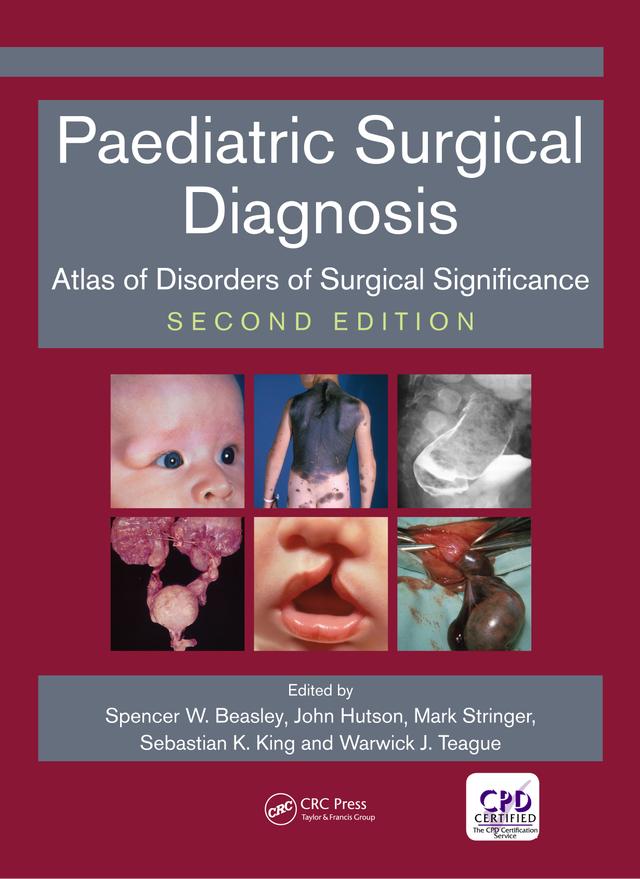 Paediatric Surgical Diagnosis by John Hutson, Mark D Stringer, Sebastian King, Spencer Beasley, Warwick Teague