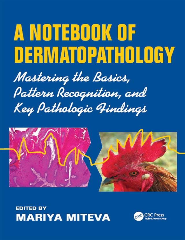 A Notebook of Dermatopathology by Mariya Miteva