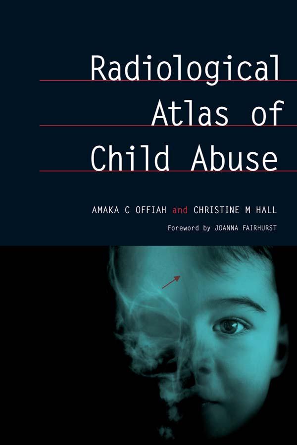 Radiological Atlas of Child Abuse by Amaka Offiah, Christine Hall