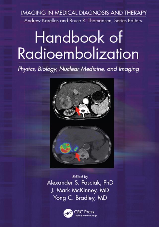 Handbook of Radioembolization by MD. Bradley, MD. McKinney, PhD. Pasciak
