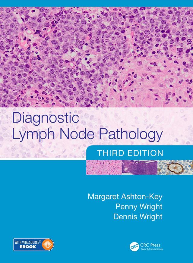 Diagnostic Lymph Node Pathology by Dennis Wright, Margaret Ashton-Key, Penny Wright