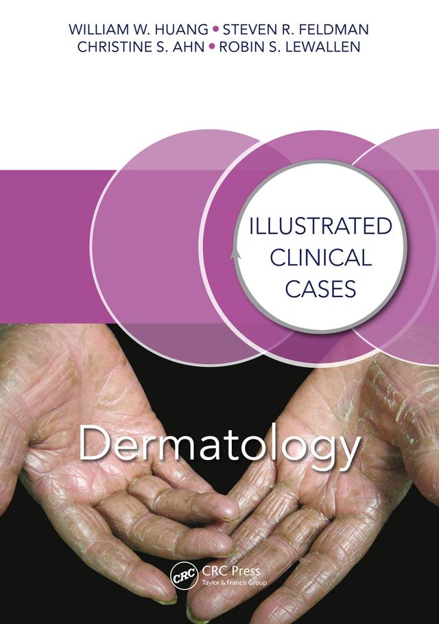 Dermatology by Christine S. Ahn, Robin S. Lewallen, Steven R. Feldman, William W. Huang