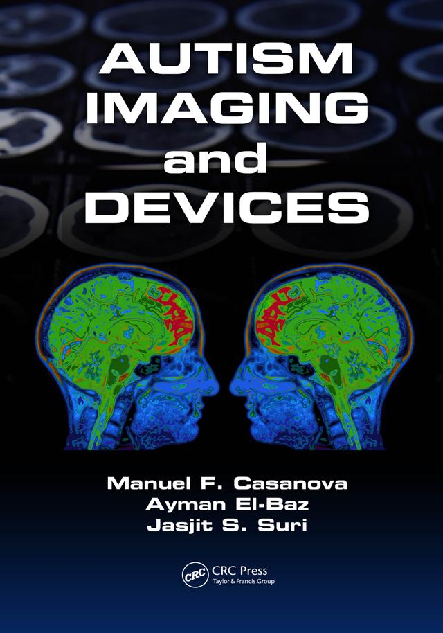 Autism Imaging and Devices by Ayman El-Baz, Jasjit S. Suri, Manuel F. Casanova