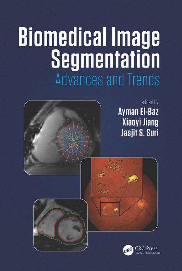 Biomedical Image Segmentation by Ayman El-Baz, Jasjit S. Suri, Xiaoyi Jiang