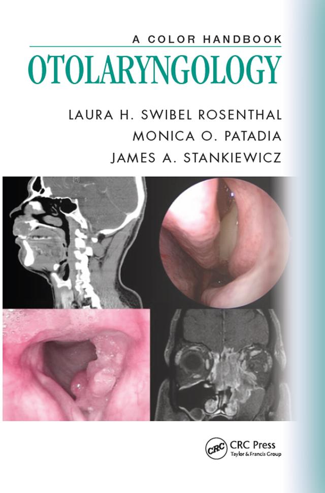 Otolaryngology by James A. Stankiewicz, Laura H. Swibel Rosenthal, Monica O. Patadia