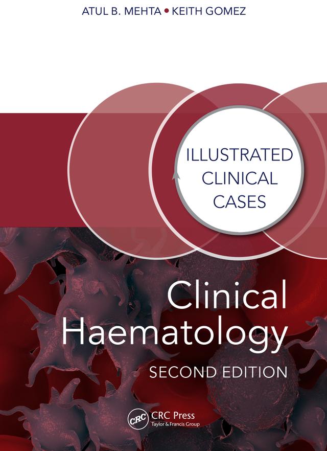 Clinical Haematology by Atul Bhanu Mehta, Keith Gomez