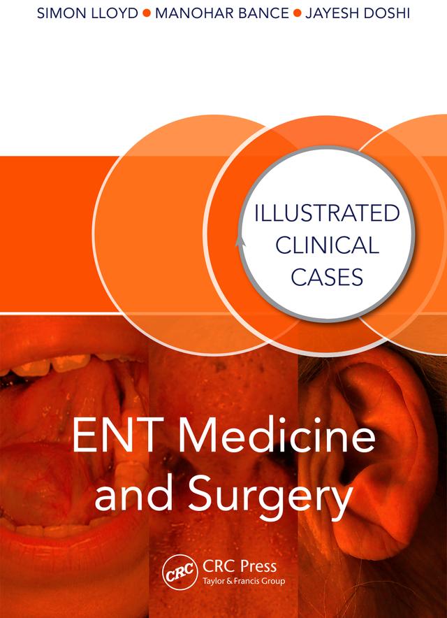 ENT Medicine and Surgery by Jayesh Doshi, Manohar Bance, Simon Lloyd