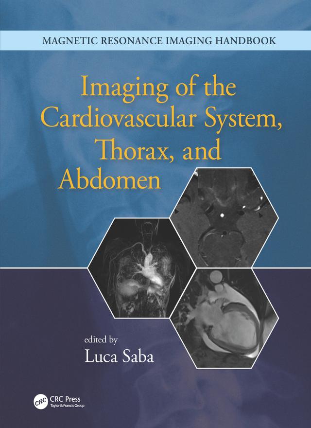 Imaging of the Cardiovascular System, Thorax, and Abdomen by Luca Saba