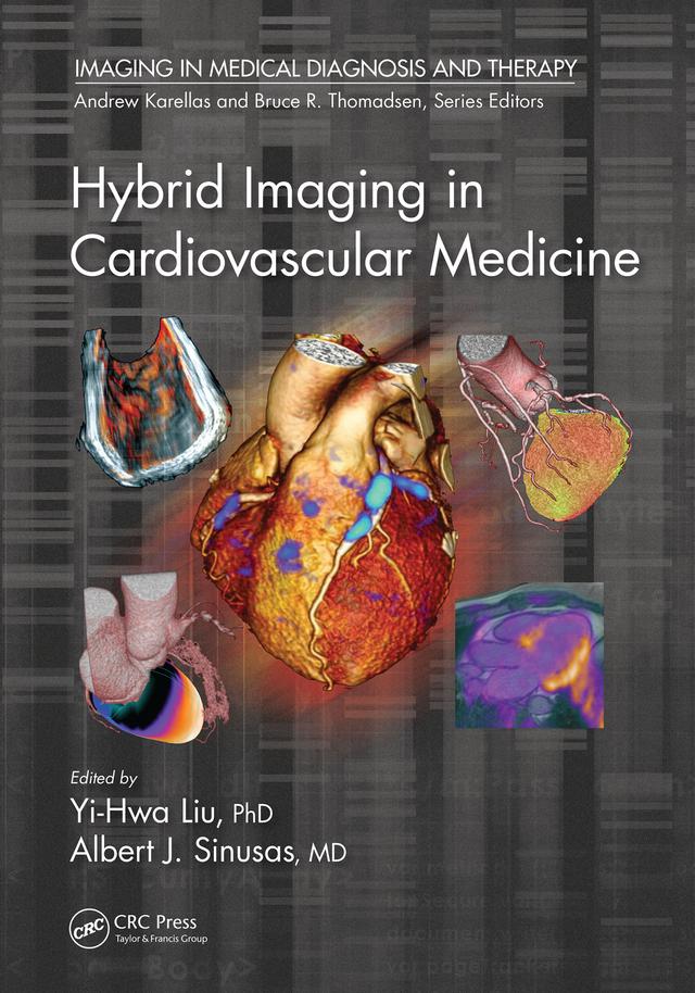 Hybrid Imaging in Cardiovascular Medicine by Albert J. Sinusas, Yi-Hwa Liu