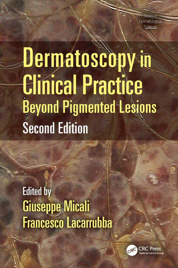 Dermatoscopy in Clinical Practice by Francesco Lacarrubba, Giuseppe Micali
