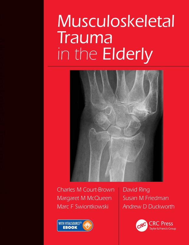 Musculoskeletal Trauma in the Elderly by Andrew David Duckworth, Charles Court-Brown, David Ring, Marc F. Swiontkowski, Margaret McQueen, Susan M. Friedman