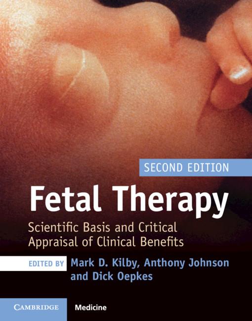 Fetal Therapy by Anthony Johnson, Dick Oepkes, Mark D. Kilby