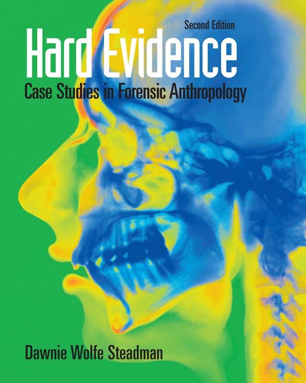 Hard Evidence by Dawnie Wolfe Steadman