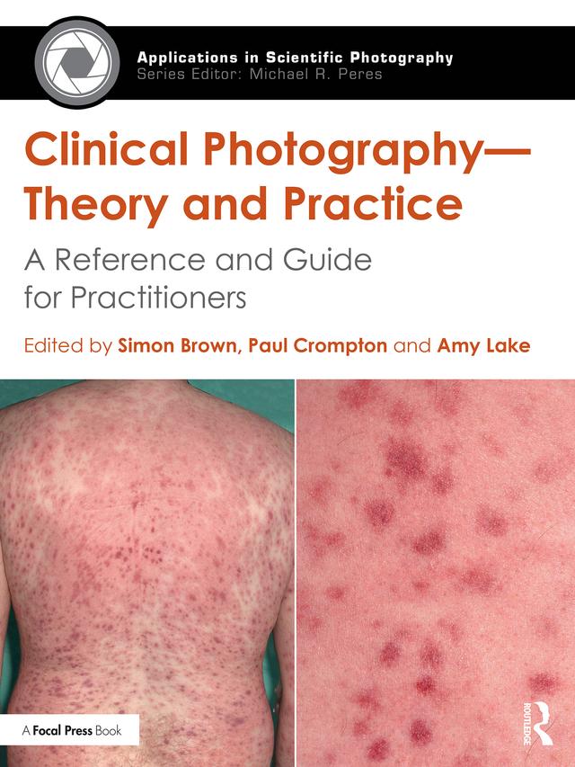 Clinical Photography — Theory and Practice by Amy Lake, Paul Crompton, Simon Brown