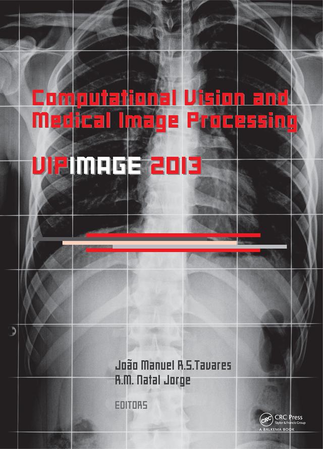 Computational Vision and Medical Image Processing IV by Joao Manuel RS Tavares, Jorge R.M. Natal