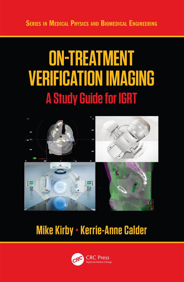 On-Treatment Verification Imaging by Kerrie-Anne Calder, Mike Kirby