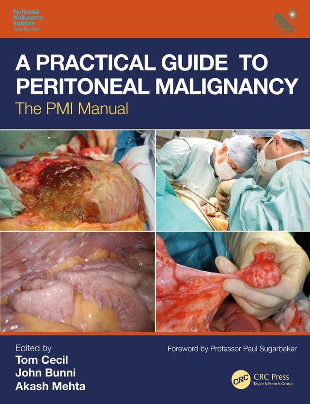 A Practical Guide to Peritoneal Malignancy by Akash Mehta, John Bunni, Tom Cecil