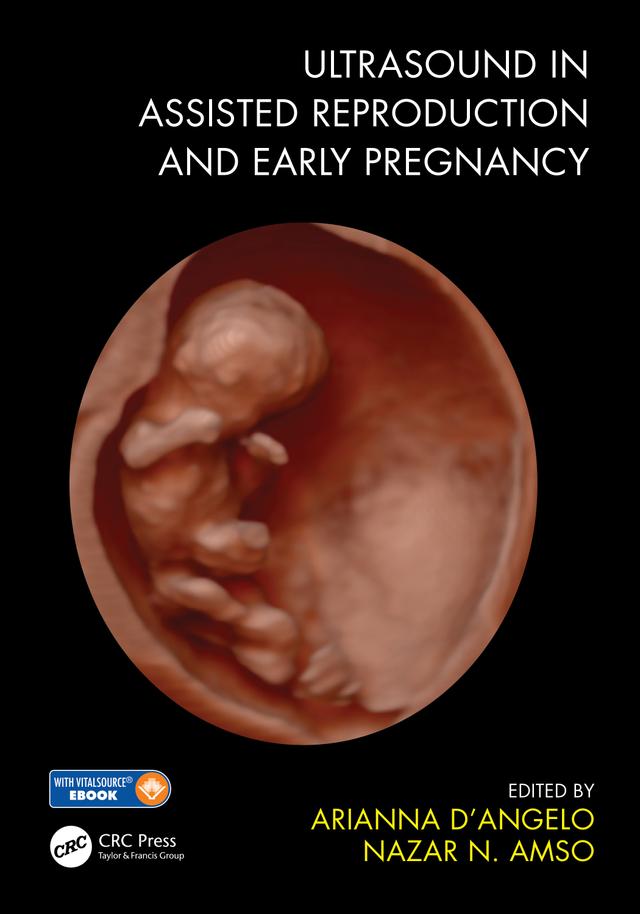 Ultrasound in Assisted Reproduction and Early Pregnancy by Arianna D'Angelo, Nazar N. Amso