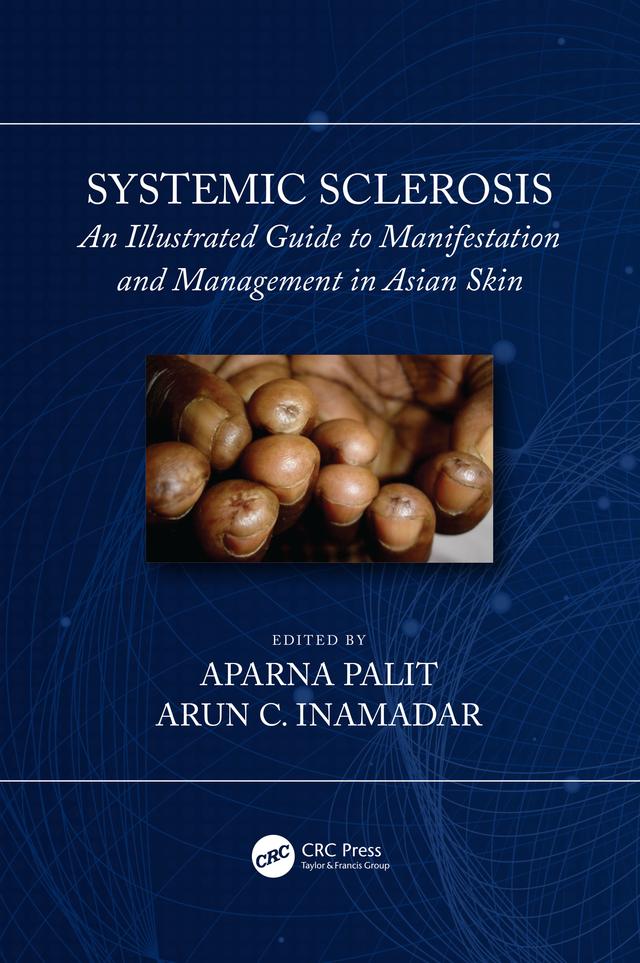 Systemic Sclerosis by Aparna Palit, Arun C Inamadar