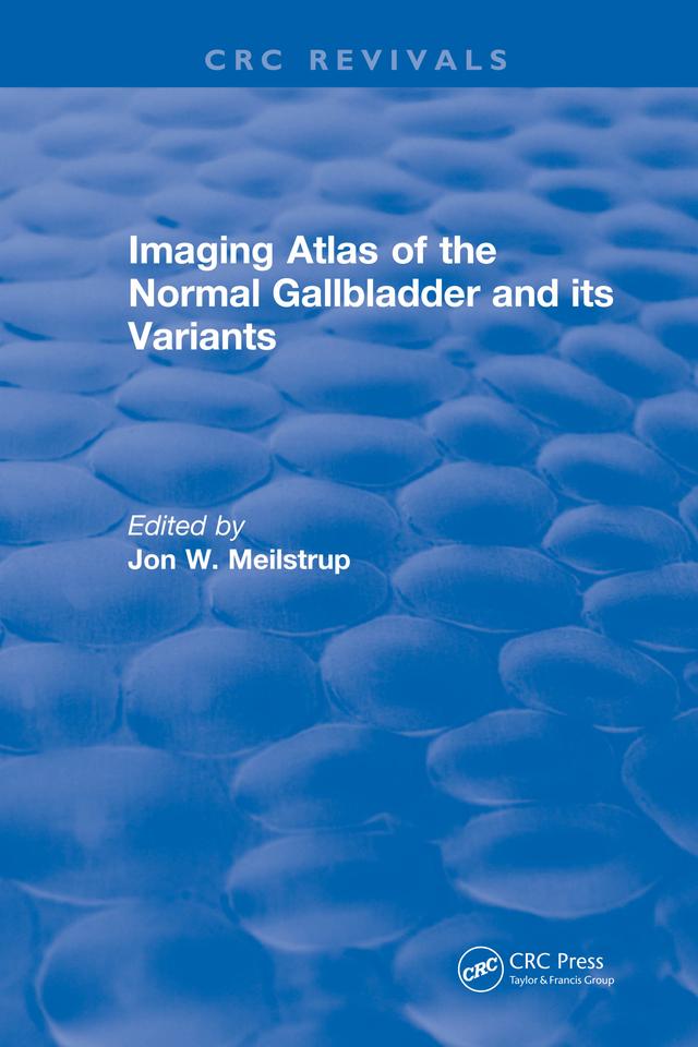 Imaging Atlas of the Normal Gallbladder and Its Variants by J.W. Meilstrup