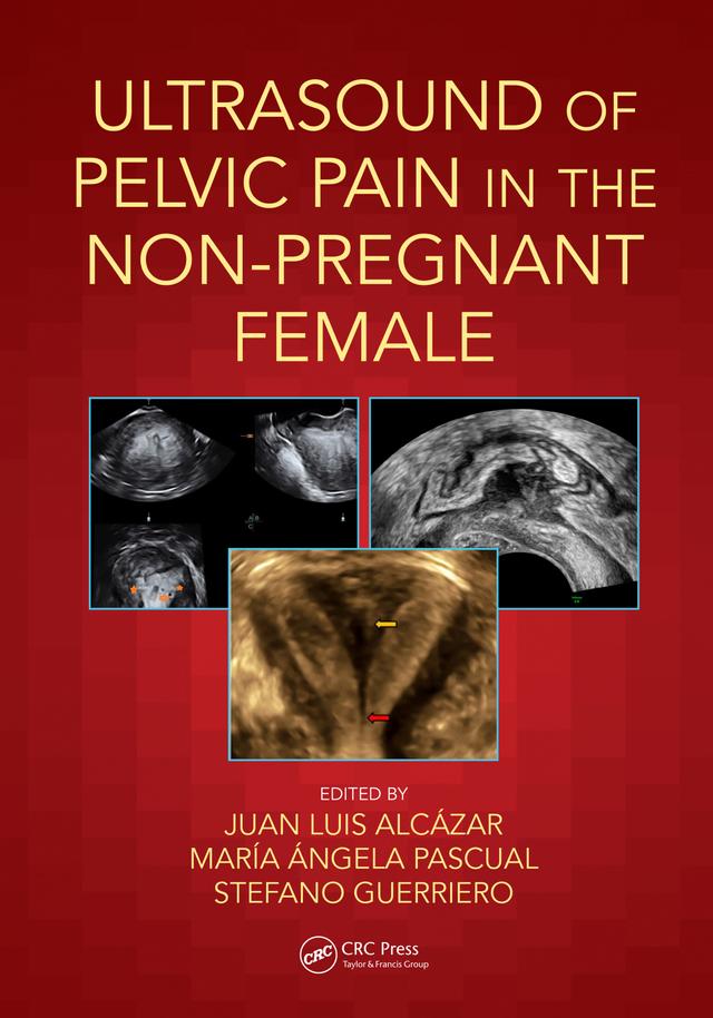 Ultrasound of Pelvic Pain in the Non-Pregnant Patient by Juan Luis Alcázar, María Ángela Pascual, Stefano Guerriero