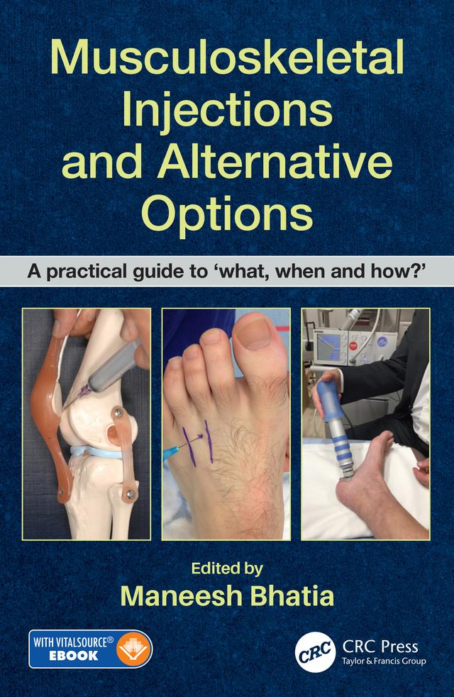 Musculoskeletal Injections and Alternative Options by Maneesh Bhatia