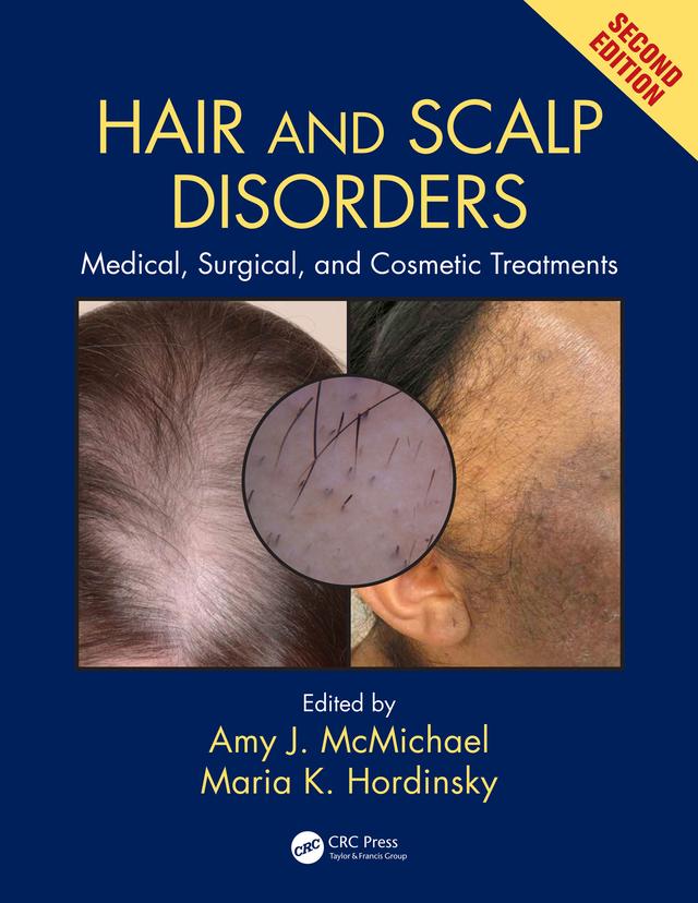 Hair and Scalp Disorders by Amy J. McMichael, Maria K. Hordinsky