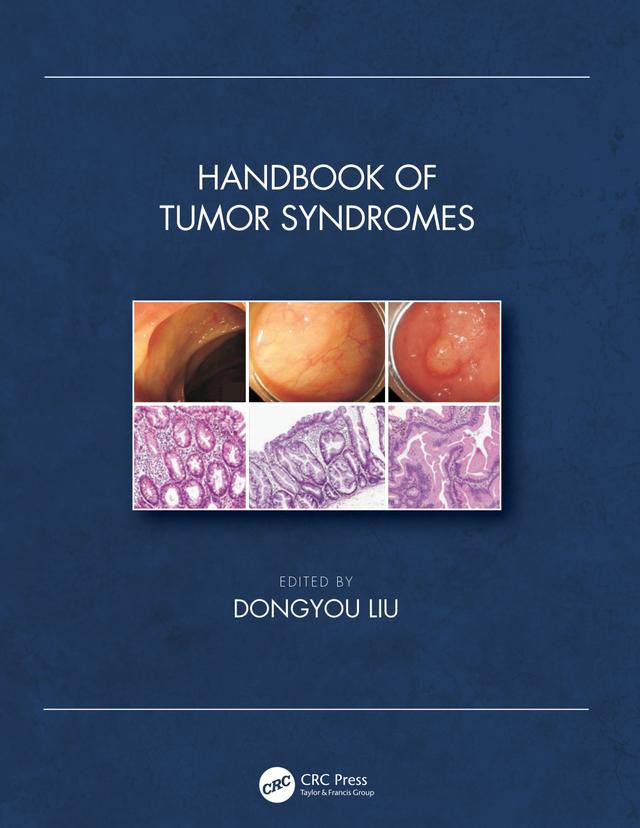 Handbook of Tumor Syndromes by Dongyou Liu