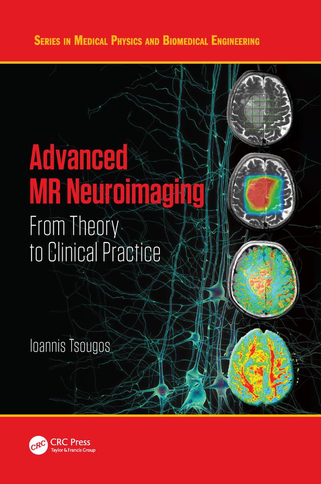 Advanced MR Neuroimaging by Ioannis Tsougos