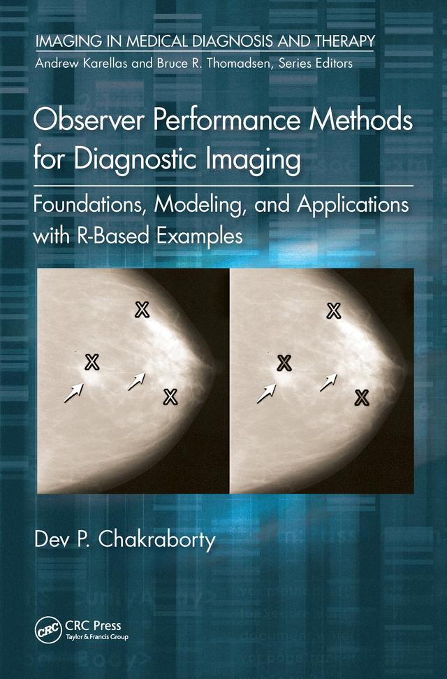 Observer Performance Methods for Diagnostic Imaging by Dev P. Chakraborty