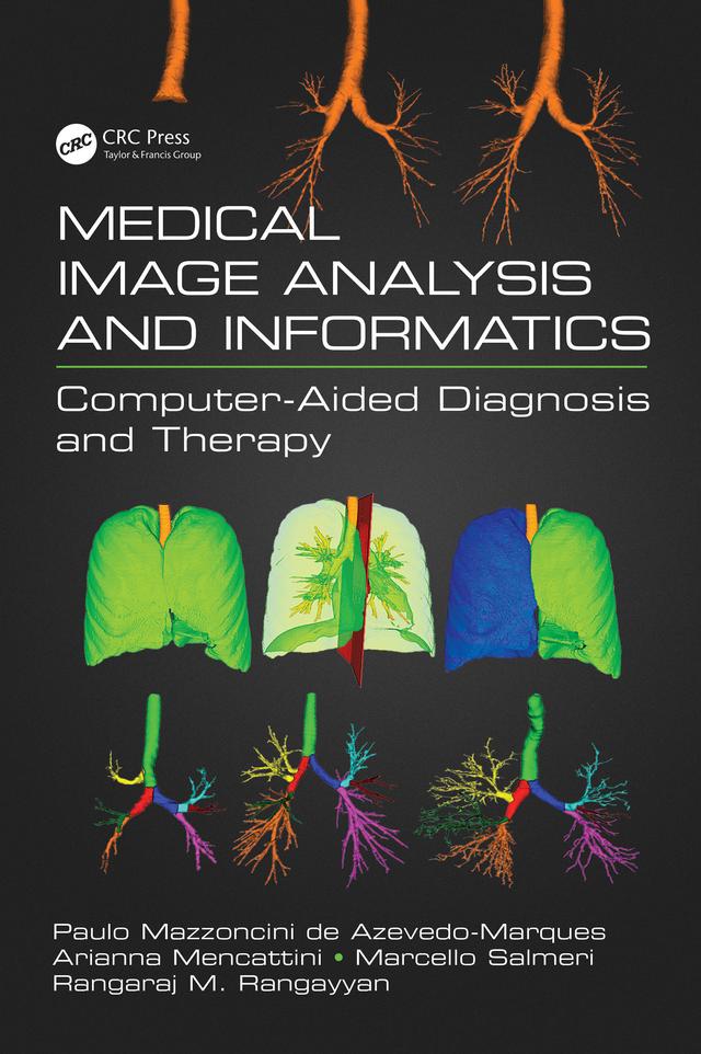 Medical Image Analysis and Informatics by Arianna Mencattini, Marcello Salmeri, Paulo Mazzoncini de Azevedo-Marques, Rangaraj M. Rangayyan