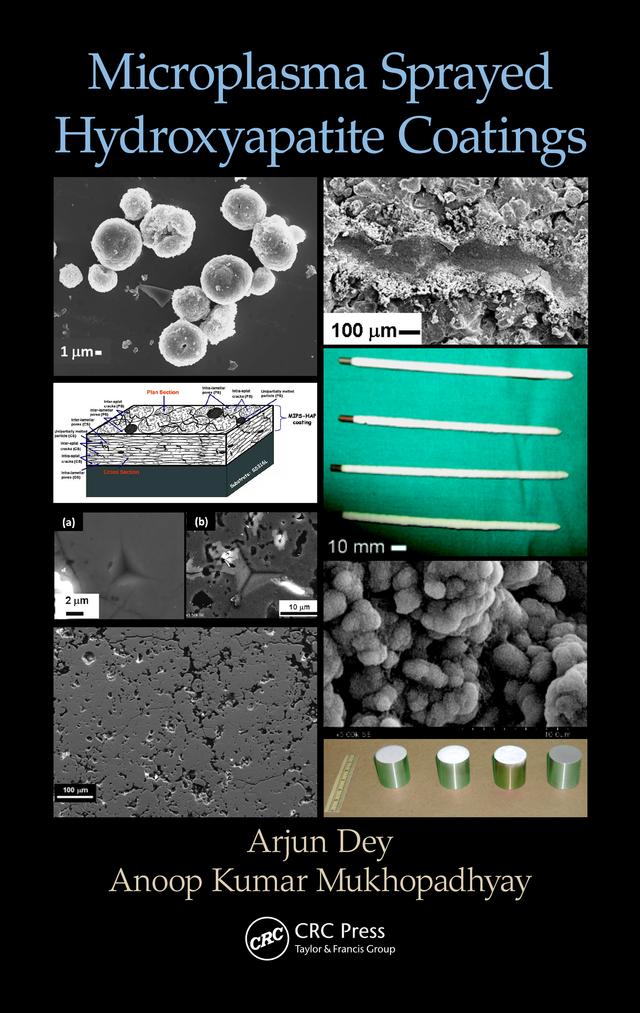 Microplasma Sprayed Hydroxyapatite Coatings by Anoop Kumar Mukhopadhyay, Arjun Dey