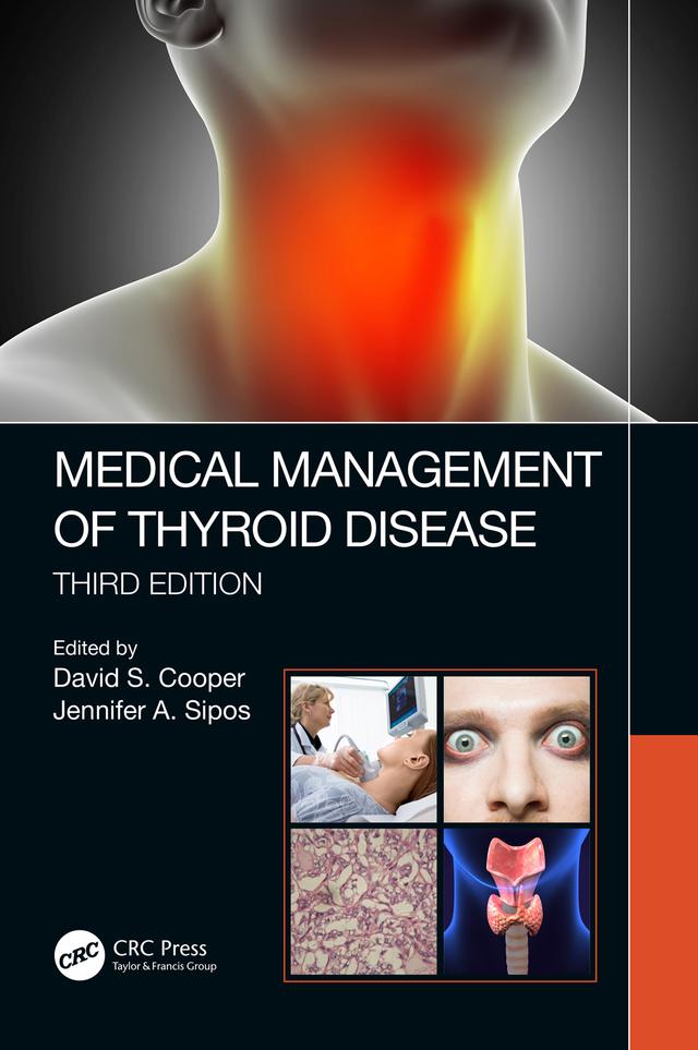 Medical Management of Thyroid Disease, Third Edition by David S. Cooper, Jennifer Sipos