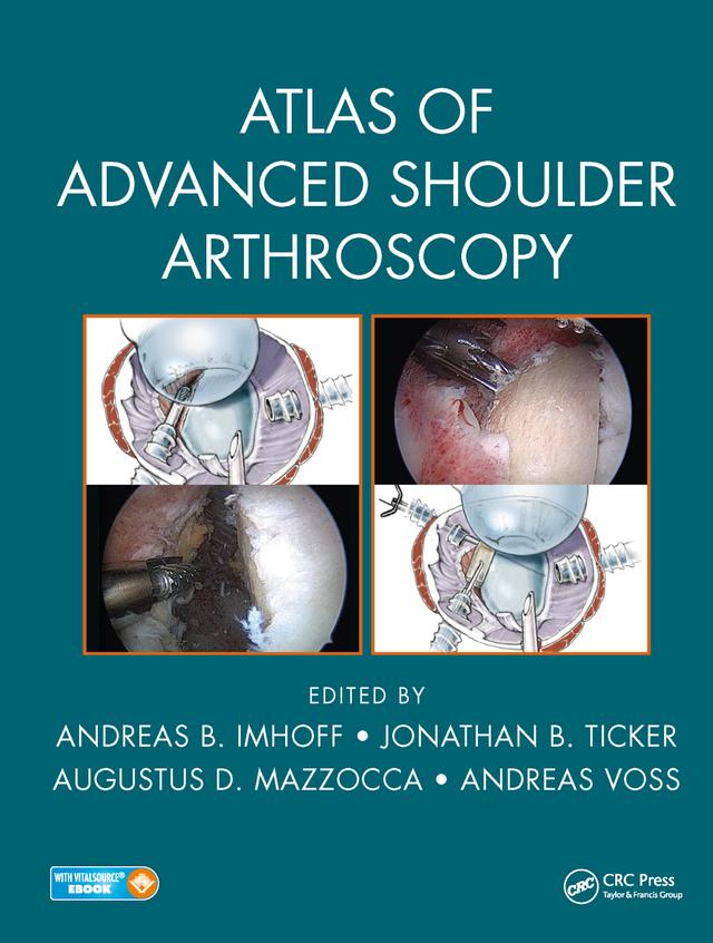 Atlas of Advanced Shoulder Arthroscopy by Andreas B. Imhoff, Andreas Voss, Augustus D. Mazzocca, Jonathan B. Ticker