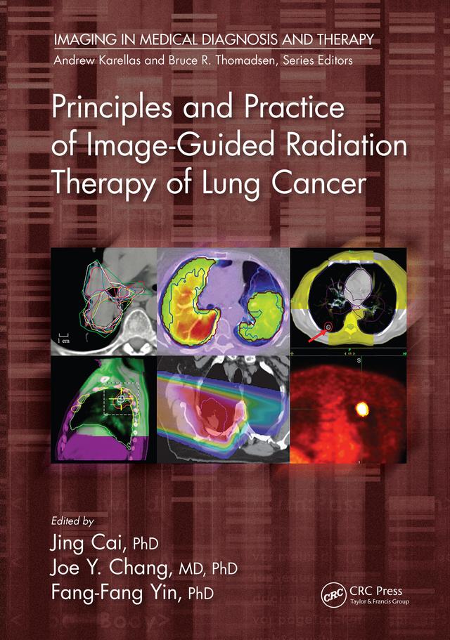 Principles and Practice of Image-Guided Radiation Therapy of Lung Cancer by Fang-Fang Yin, Jing Cai, Joe Y. Chang