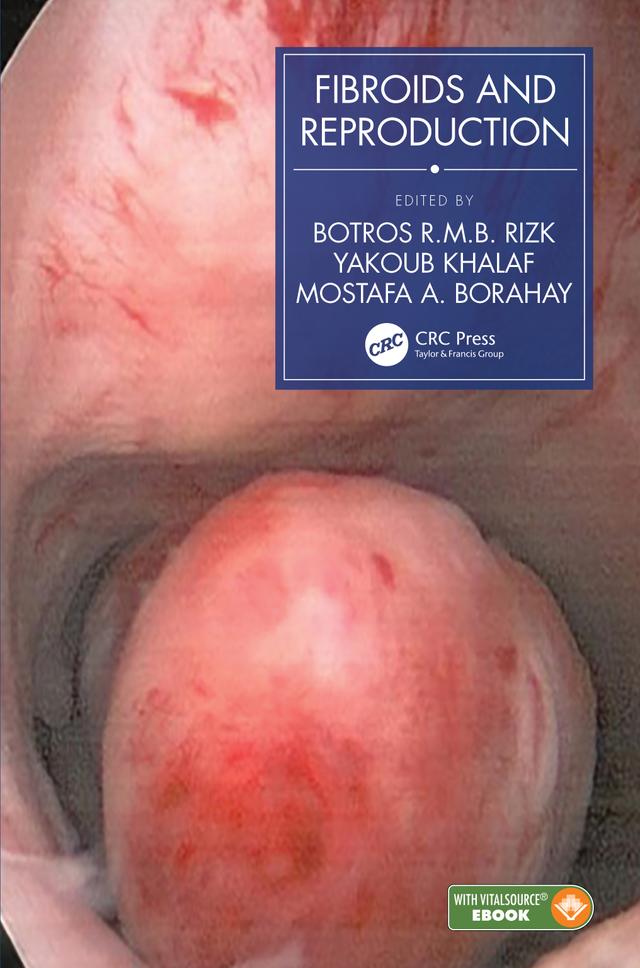 Fibroids and Reproduction by Botros R.M.B. Rizk, Mostafa A. Borahay, Yakoub Khalaf