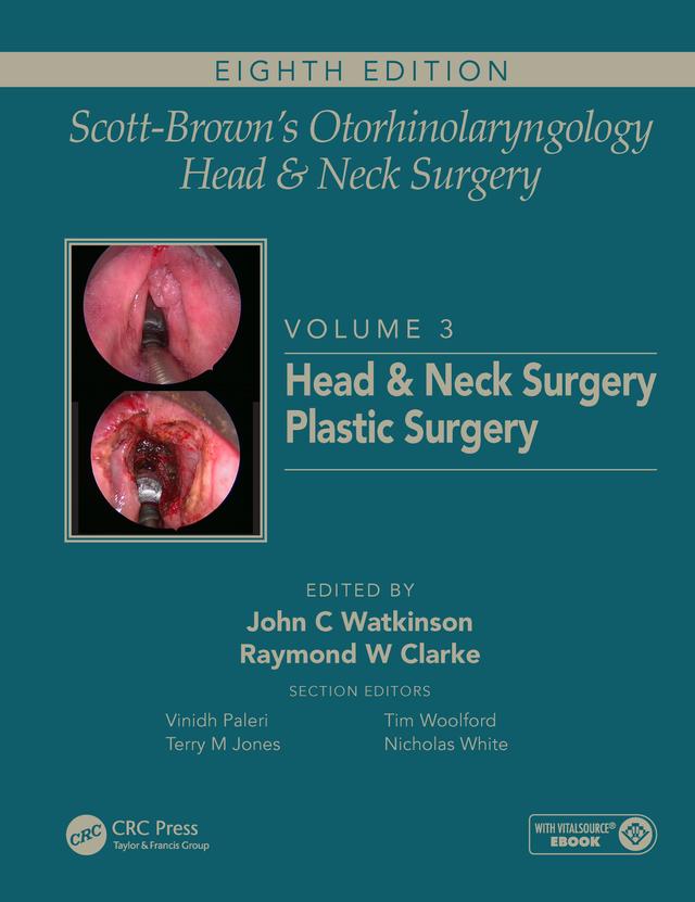 Scott-Brown's Otorhinolaryngology and Head and Neck Surgery by John Watkinson, Ray Clarke