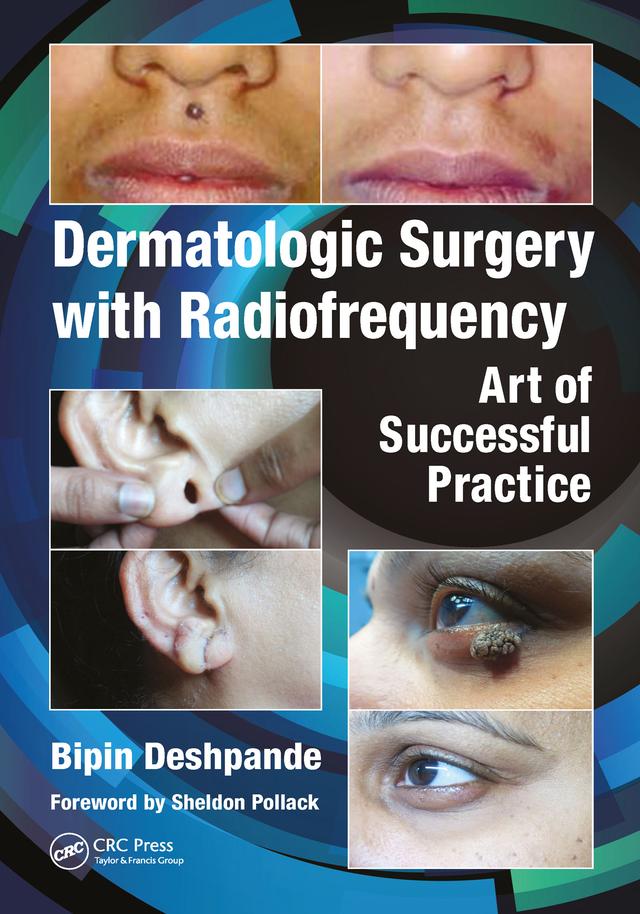 Dermatologic Surgery with Radiofrequency by Bipin Deshpande