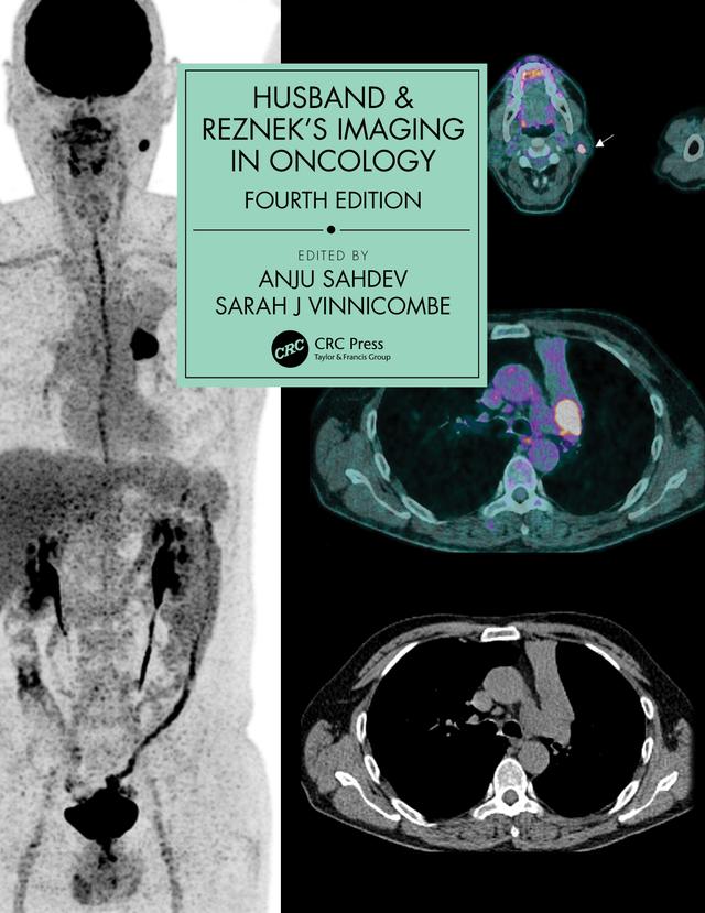 Husband & Reznek's Imaging in Oncology by Anju Sahdev, Sarah J. Vinnicombe