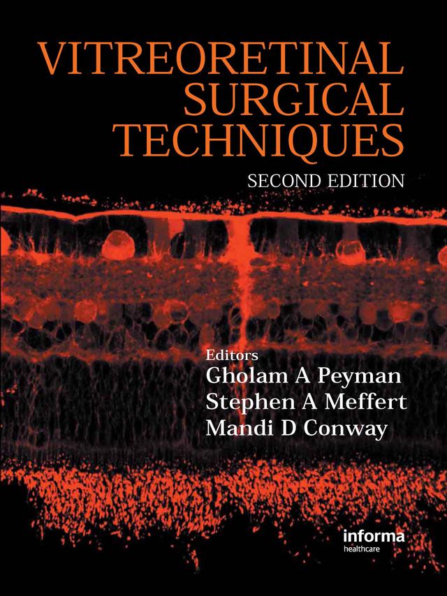 Vitreoretinal Surgical Techniques, Second Edition by Gholam A. Peyman