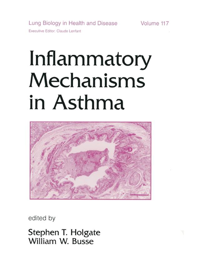 Inflammatory Mechanisms in Asthma by Stephen Holgate