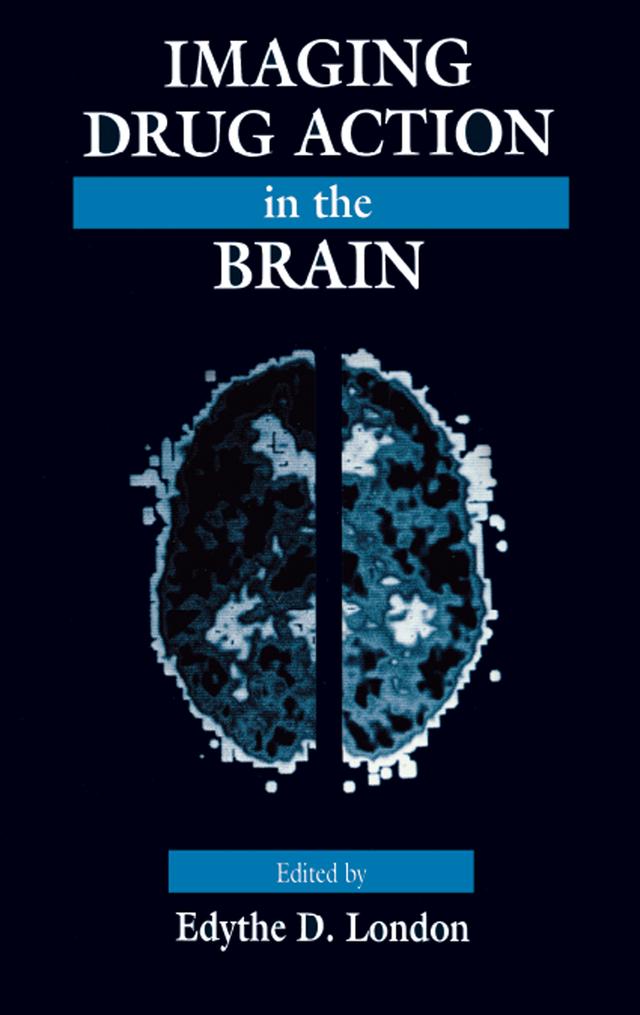 Imaging Drug Action in the Brain by Edythe D. London