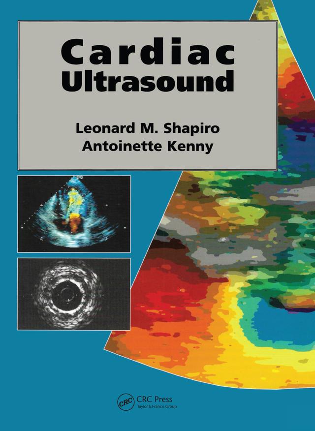 Cardiac Ultrasound by Leonard Shapiro