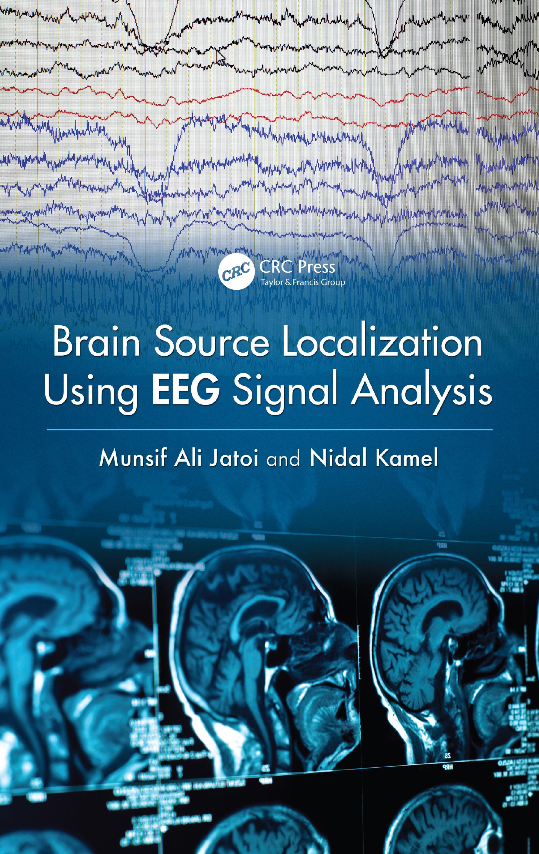 Brain Source Localization Using EEG Signal Analysis